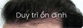 Duy trì ổn định
