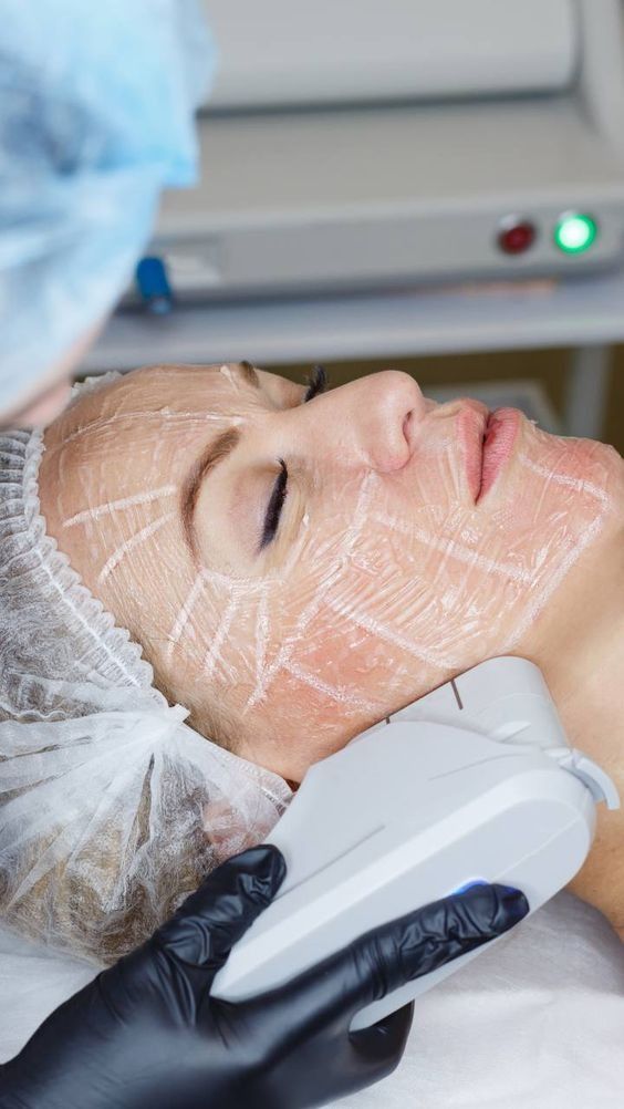 HIFU Ultherapy Plus
