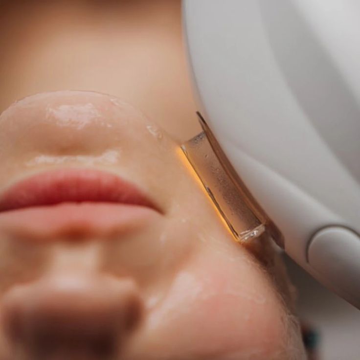 HIFU Ultherapy Plus