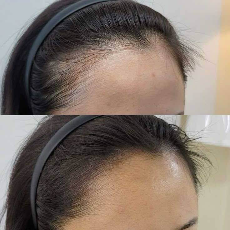 Kết quả liệu trình 1