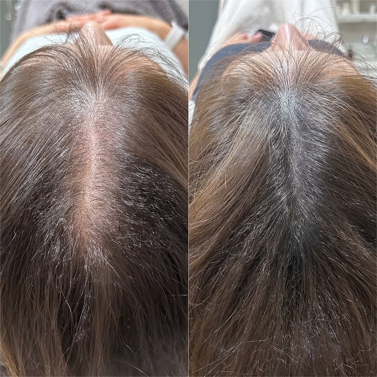Kết quả liệu trình 3