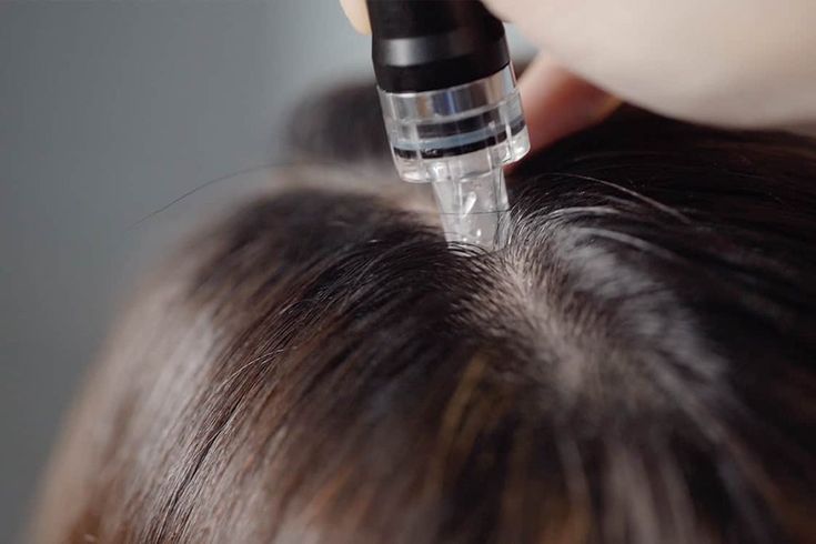 Meso Hair Plus Tú An Clinic