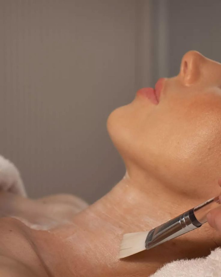 Peel Acne Clinic