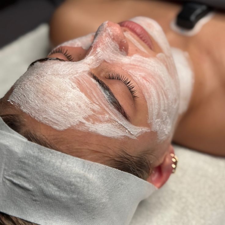 Peel Acne Clinic quy trình