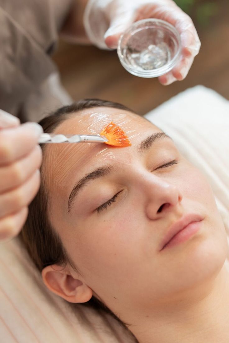 Peel Acne Clinic
