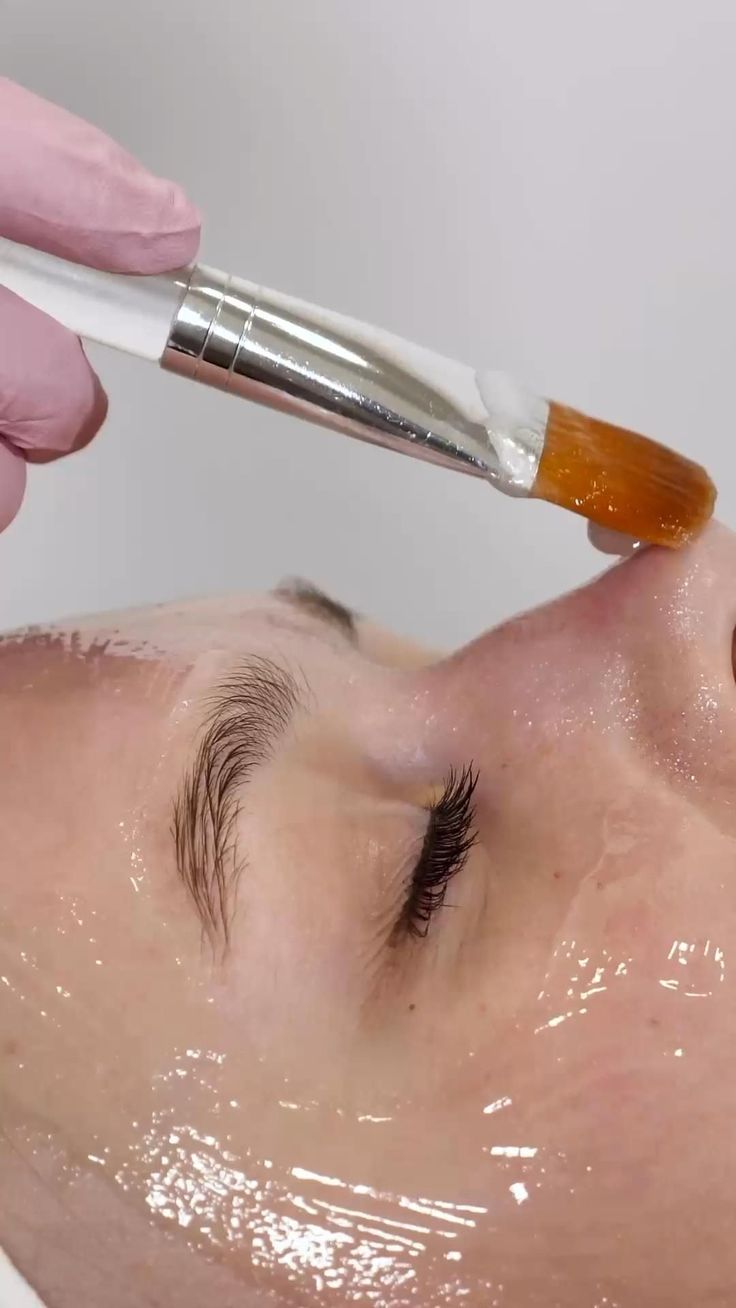 Peel Recovery